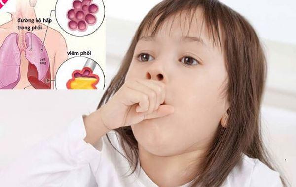 Những dấu hiệu bệnh viêm phổi và viêm tai giữa ở trẻ mẹ cần biết điều trị kịp thời