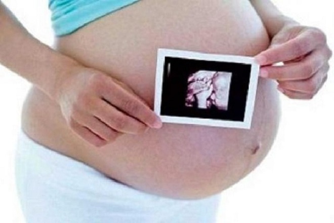 siêu âm phát hiện dị tật thai nhi