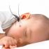 Da trẻ sơ sinh sần sùi - nguyên nhân do đâu và cách điều trị như thế nào, mẹ đã biết chưa?